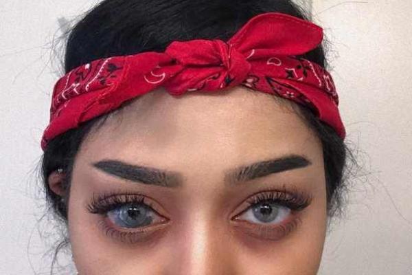 眼睛上的胎记算命分析